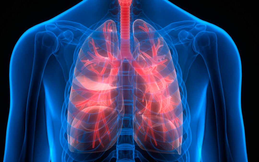 Reparan pulmones humanos dañados mediante circulación cruzada xenogénica